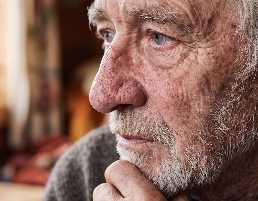 Close-up of an older man with a red, enlarged nose.
