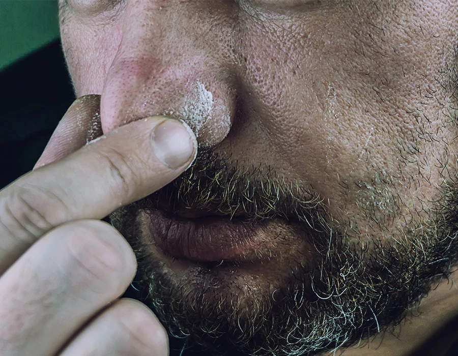 Close-up of a man’s nose with white powder residue around the nostril, illustrating cocaine nose